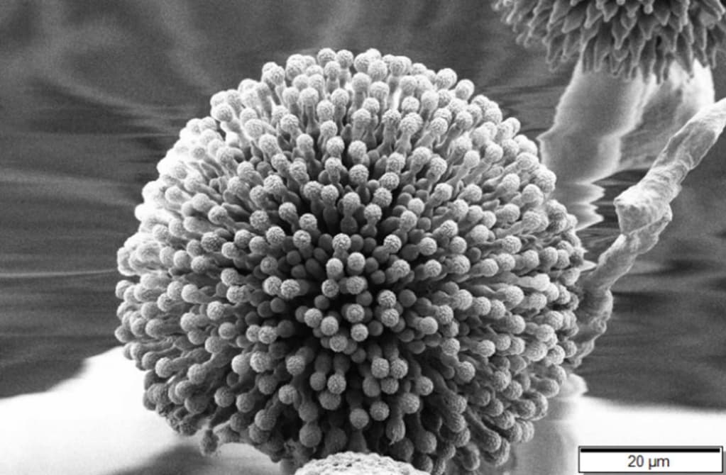 Aspergillus_niger_SEM.jpg